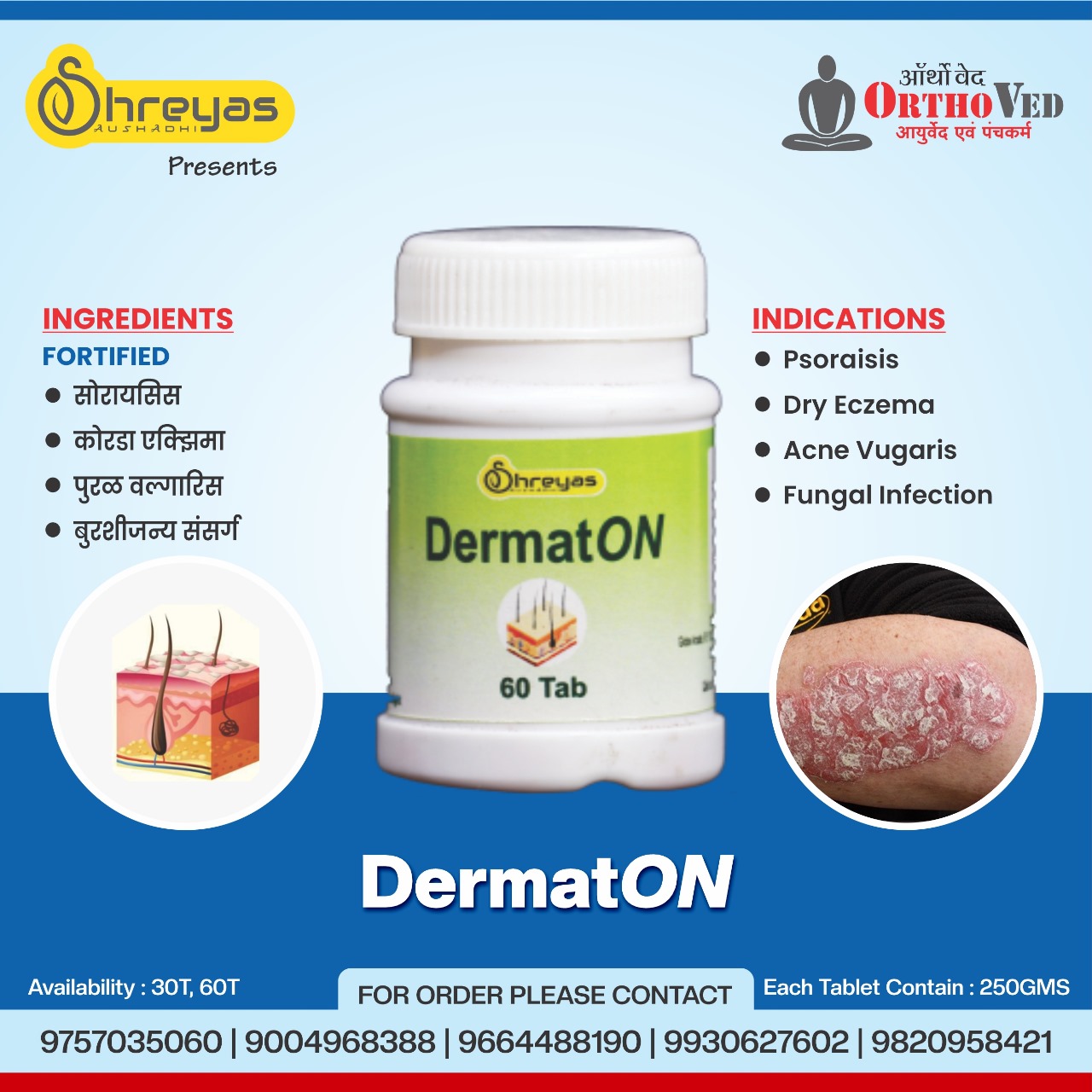 DermatOn