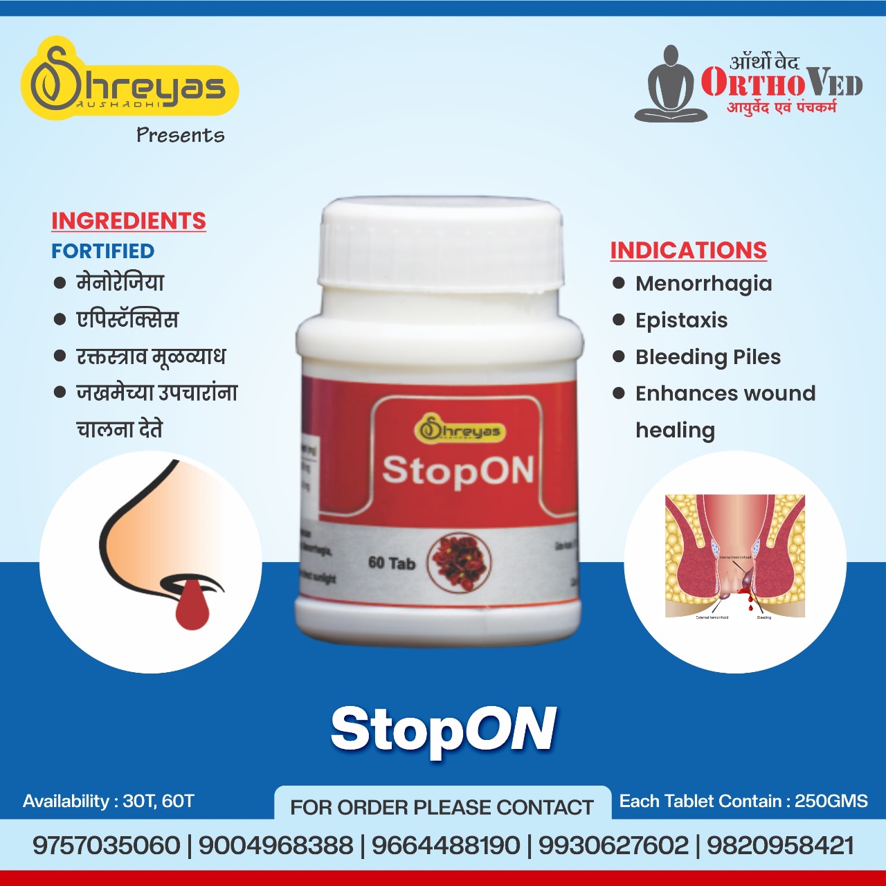StopON
