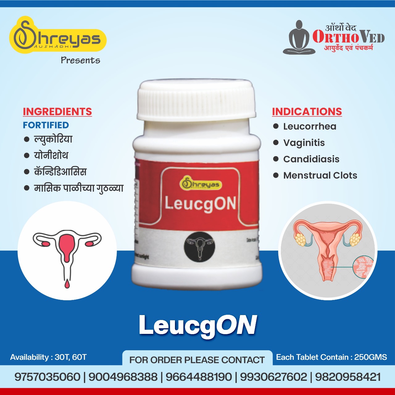 LeucgON